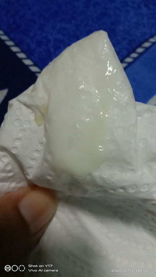 แม่ๆคนไหนเคยเป็นแบบนี้มั้ยค่ะ