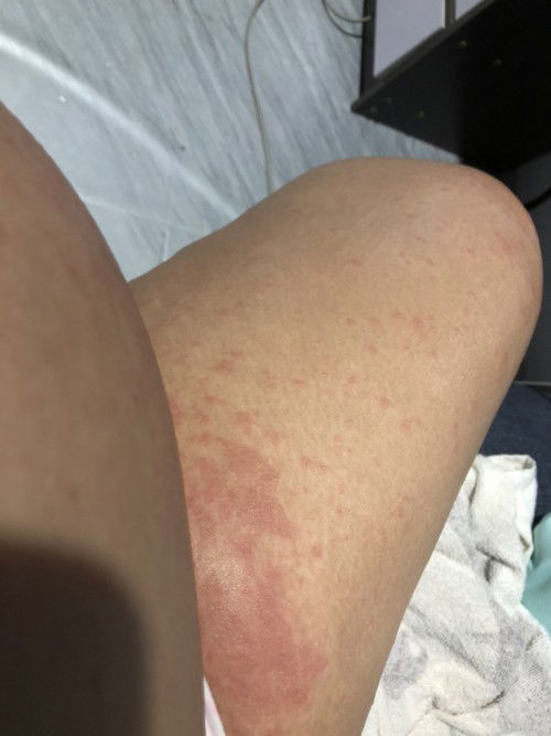 อยากถามแม่ๆหน่อยค่ะ