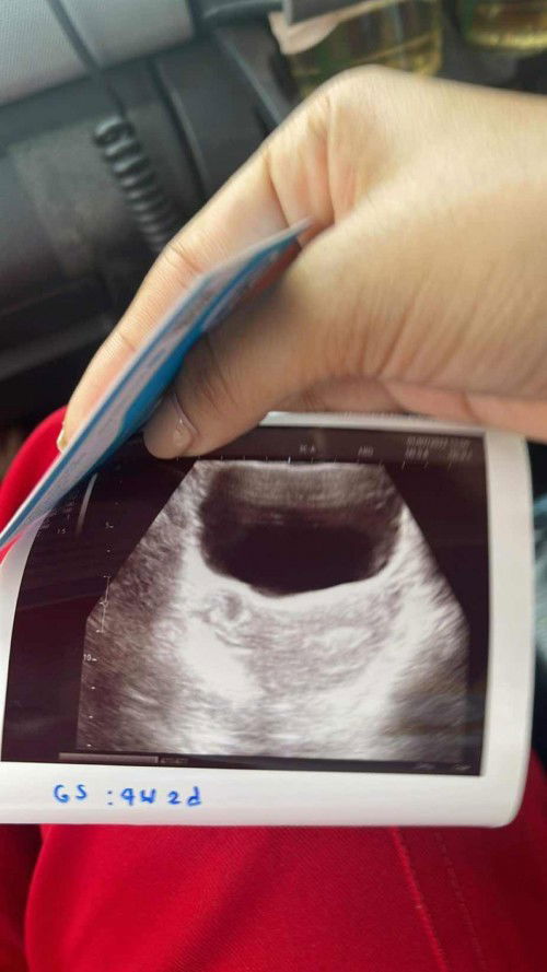 ก้าวแรกของเบบี้👨‍👩‍👧‍👦