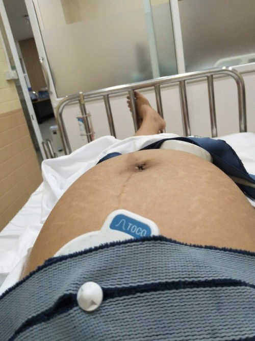 ปวดท้อง
ปวดท้อง แต่น้องไม่ยอมออก 39+4กำหนด3ก.ค แม่บ้านไหนเป้นเหมือนเราบ้างคะ