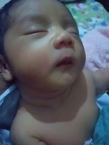BAYI KUNING