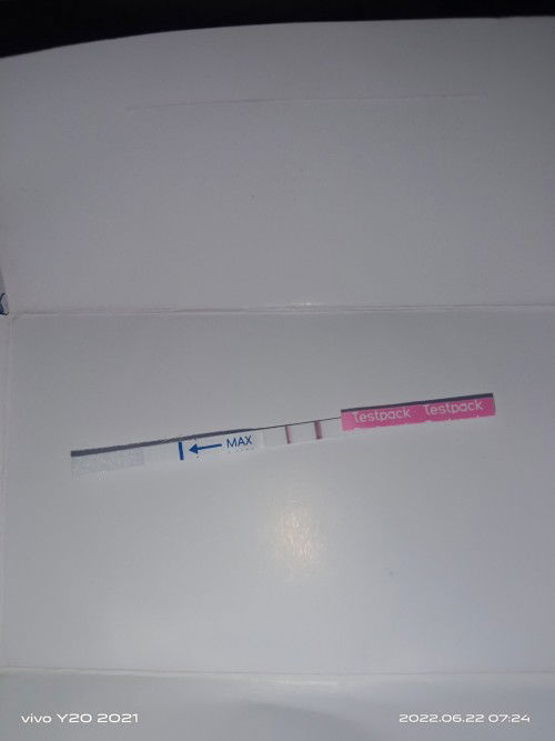 Bun alhamdulillah ya saya hamil anak pertama,saya hamil sudah 7minggu 5hari,minta doa nya ya bunda