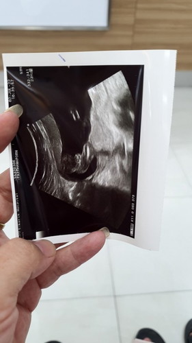 ผญ หรือ ผช