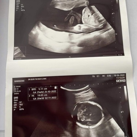 สอบถามเพศลูกค่ะ