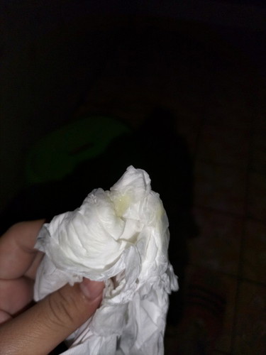 มีมูกออกมาตอน38+1w