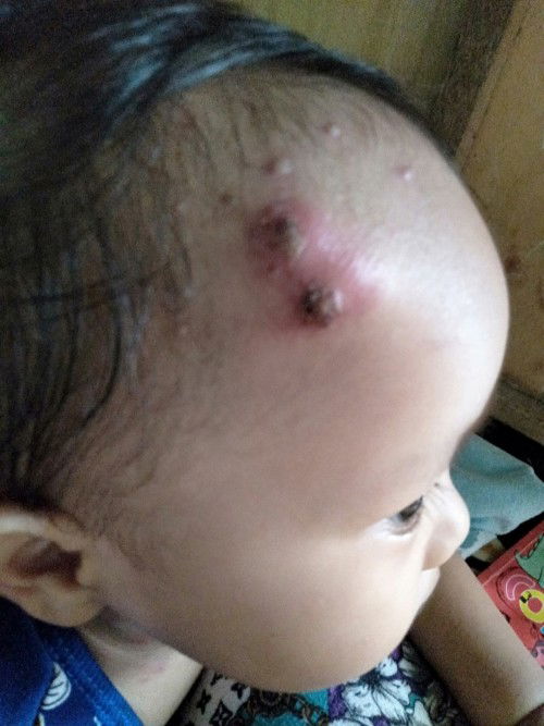 Ano po Kaya ito mommies?