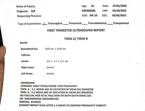 Twins 9 weeks from the last Menstration pero 5 weeks and 1 day sa TVS