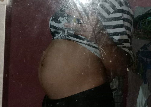 ท้องแบบนี้ผู้หญิงหรือผู้ชายคะ