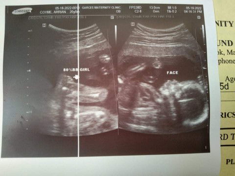 Gender: Boy or Girl??