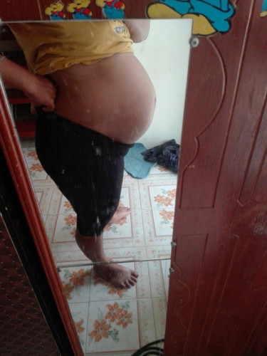 33วีคแม่มีอาการยังไงกันบ้างคะ