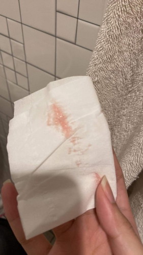 ประจำเดือนไม่มา