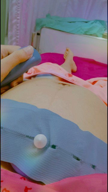 ท้อง38+3   มีน้ำเดิน