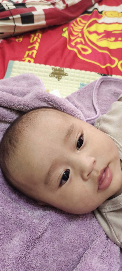 Bun mau nanya anak saya kepalanya kaya ada bandonya kenapa ya bund? Mohon dijawab yaa bund jadi wory