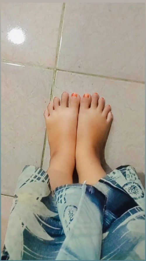 Kaki pegel dan bengkak