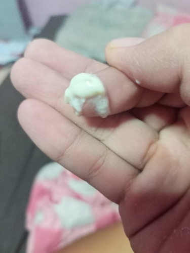 ขอถามค่ะ เชื้อรา