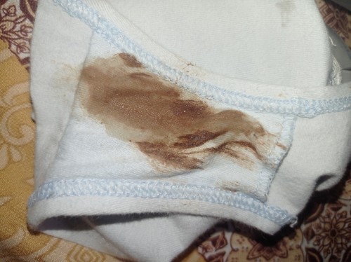 Keluar flek coklat dari ms v balita