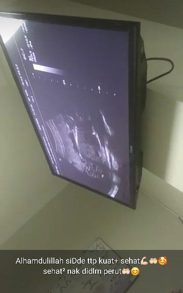 Usia 5 bulan baby udah jungkir