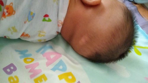 ผมแหว่งเป็นจุด