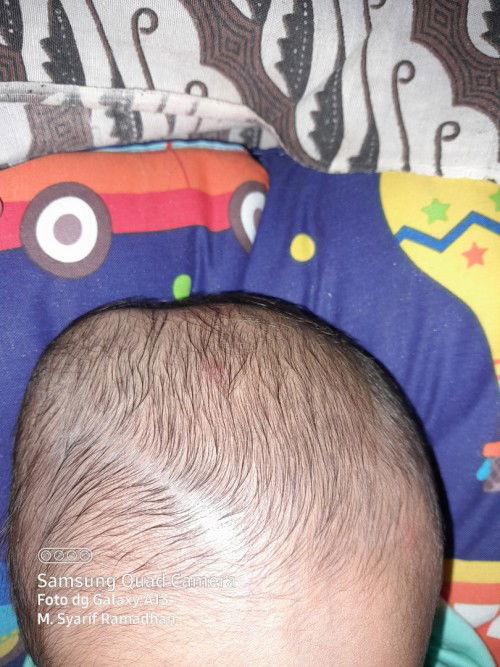 Benjolan awalnya lembek jadi mengeras