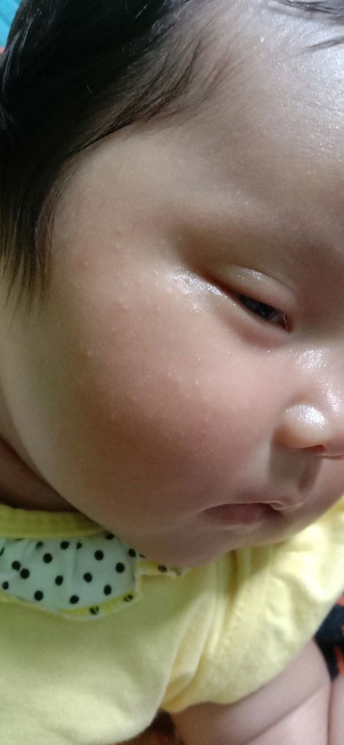 Bruntusan, merah merah