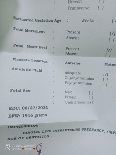bakit Po kaya ganon ultrasound ko Sabi girl tas pag dating sa fetal sex undetermined