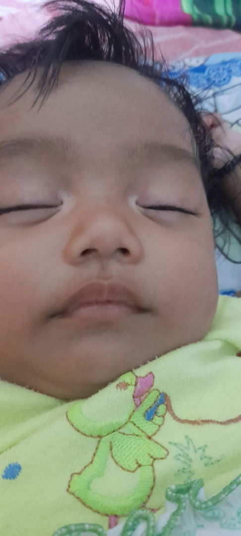 Bercak putih disebelah mata