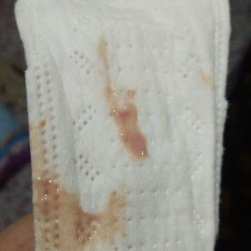 Brown discharge @28weeks😔pasintabi po sa pic....