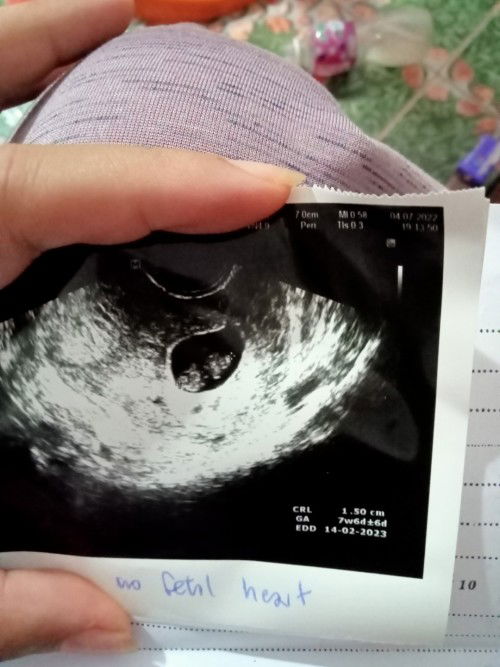 ใครพอมีประสบการณ์ช่วยแนะนำหน่อยนะค่ะ🙏🙏🙏