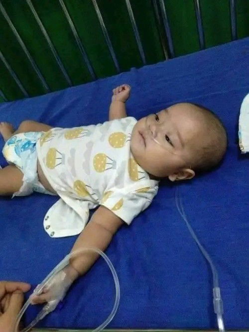 CONGENITAL HEART DESEASE DORV-VSD