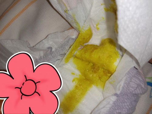 𝗙𝗼𝗿𝗺𝘂𝗹𝗮 𝗙𝗲𝗱 𝗣𝗼𝗼𝗽