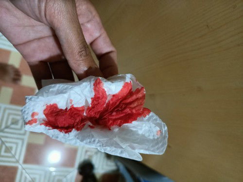 Bedrest na naman🥺