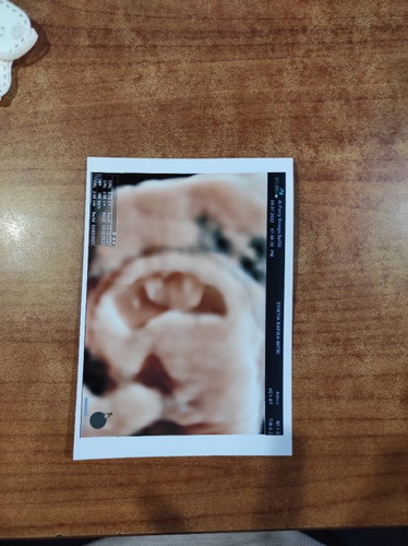 Alhamdulillah baru saja tadi USG pertama kali.
Kehamilan pertama dan sehat janinnya