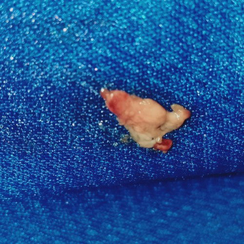 Possible miscarriage?