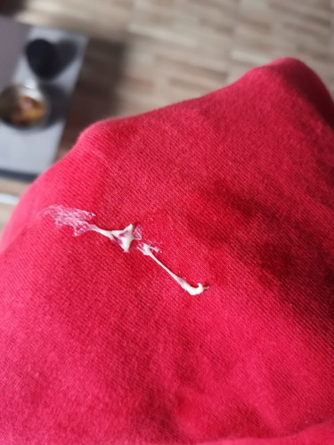 Discharge po ba ito?