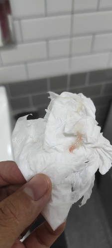 มูกออกแค่นี้แล้วก็หายไป