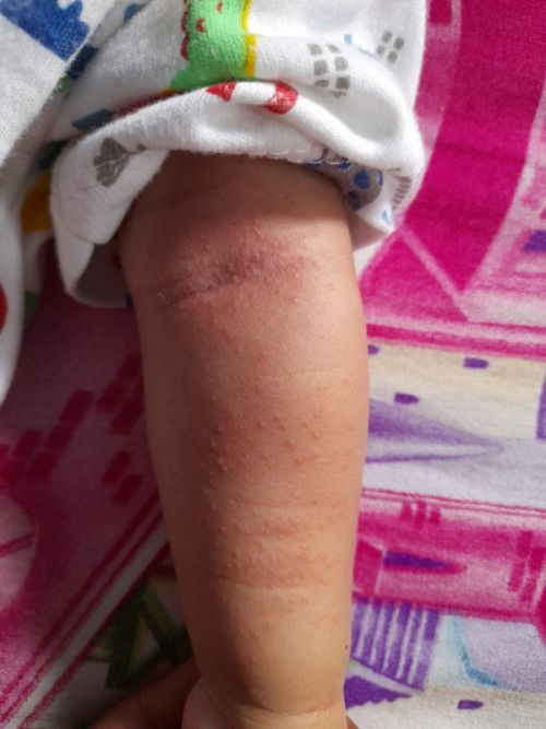 Badan bintik-bintik merah