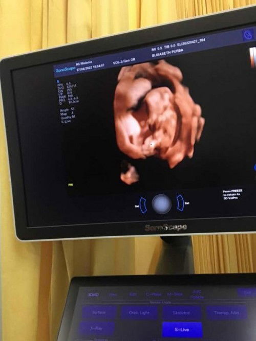 Covid saat hamil
Mau sharing pengalaman luar biasa aku dan super debay