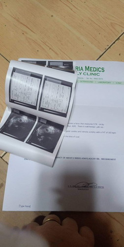Transv ultrasound