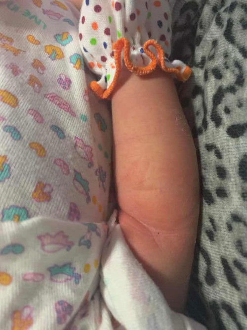 ผืนลูกแบบนี้คืออะไรคะ กังวลใจมาก