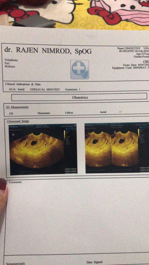 Usia 10 week masih kantong