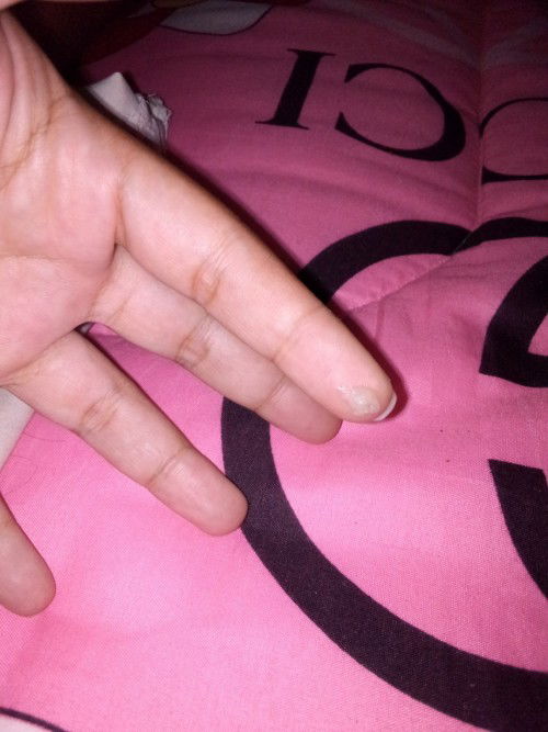 ขออภัยในรูปภาพไม่เหมาะสมน่ะค