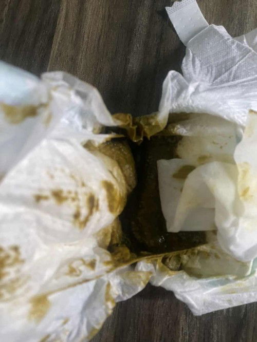 Bayi 2bulan najis hijau kehitaman