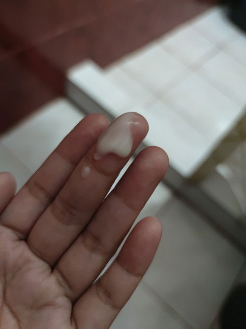 white discharge while pregnant