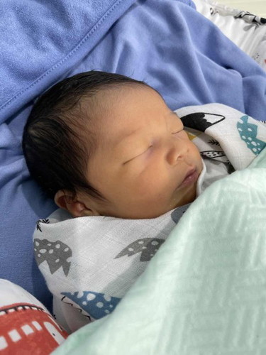 ลูกมีอาการตัวเหลือง