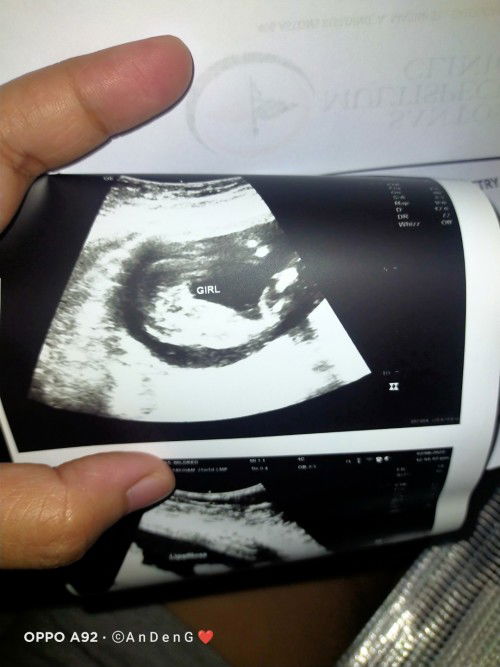 No more sana all 😊😍