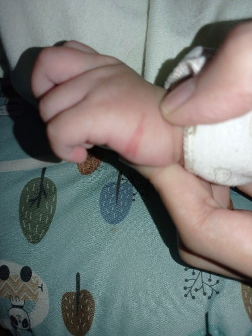 Garis merah ditangan