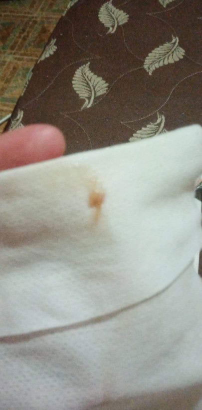 ท้อง39วีคกระตุ้นปากมดลูก