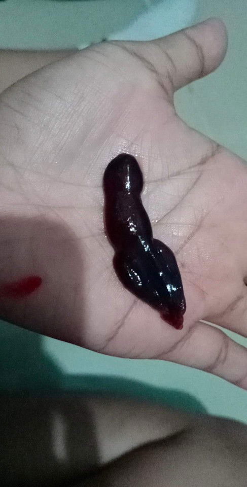 Hello mommies' pwde po mag tanong kung sino nakaranas ng kagaya sakin..