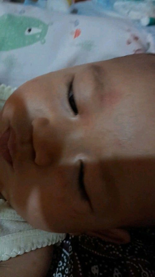 Lebih baik ke DSA atau dokter kulit?