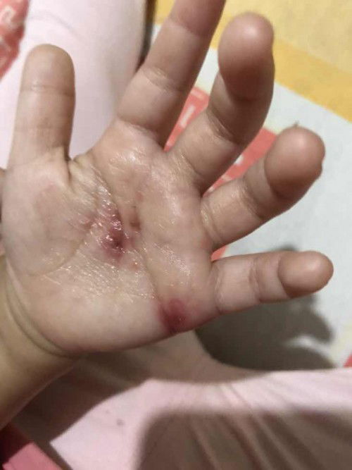 Penyakit apakah ini?